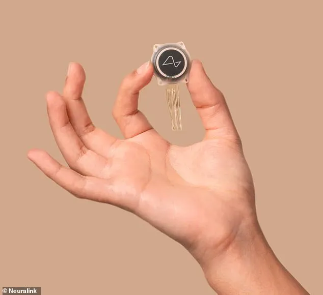 Late-Breaking Update: Elon Musk's Neuralink Patient 'Patient 4' Vanishes, Raising Alarms