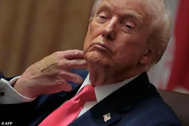 Late-Breaking Health Concerns: Trump's Diet and Fatigue Spark Expert Debate