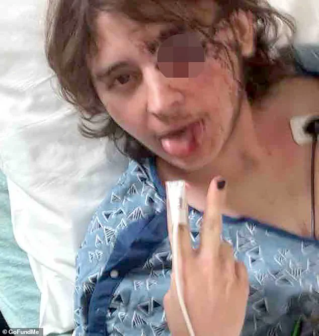 Projectile Strike During Protest Leaves 21-Year-Old With Permanent Vision Loss, Sparking Debate Over Law Enforcement Use Of Force