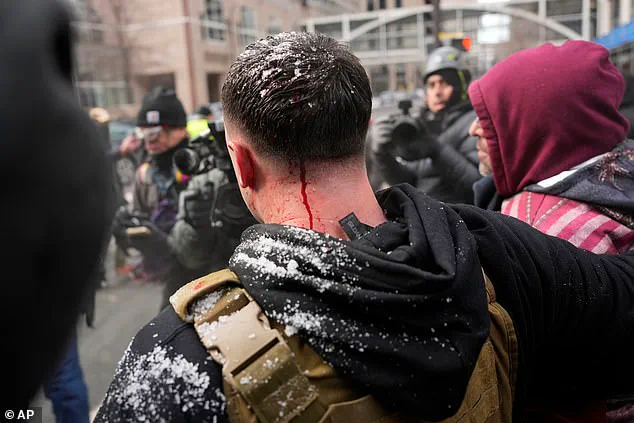 Violent Clash Erupts in Minneapolis During Protest Over Alleged Daycare Fraud, Injuring Conservative Candidate