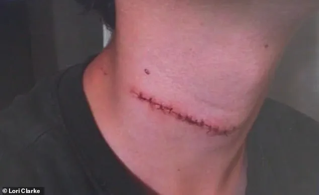 Daytona Beach Tragedy: 13-Year-Old's Throat Slashed in Boardwalk Attack